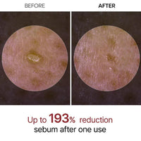 Dr.Melaxin - Peel Shot Duo Bundle Set