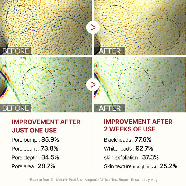 Exfoliant & Purifying Rice Ampoule