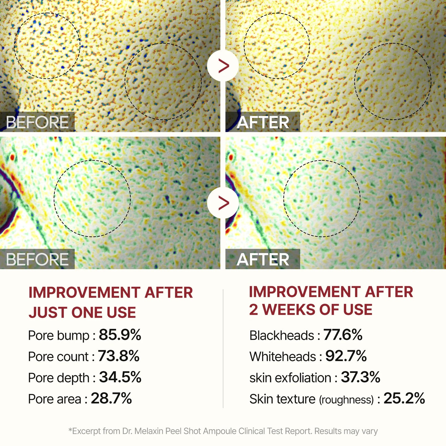 Exfoliant & Purifying Rice Ampoule