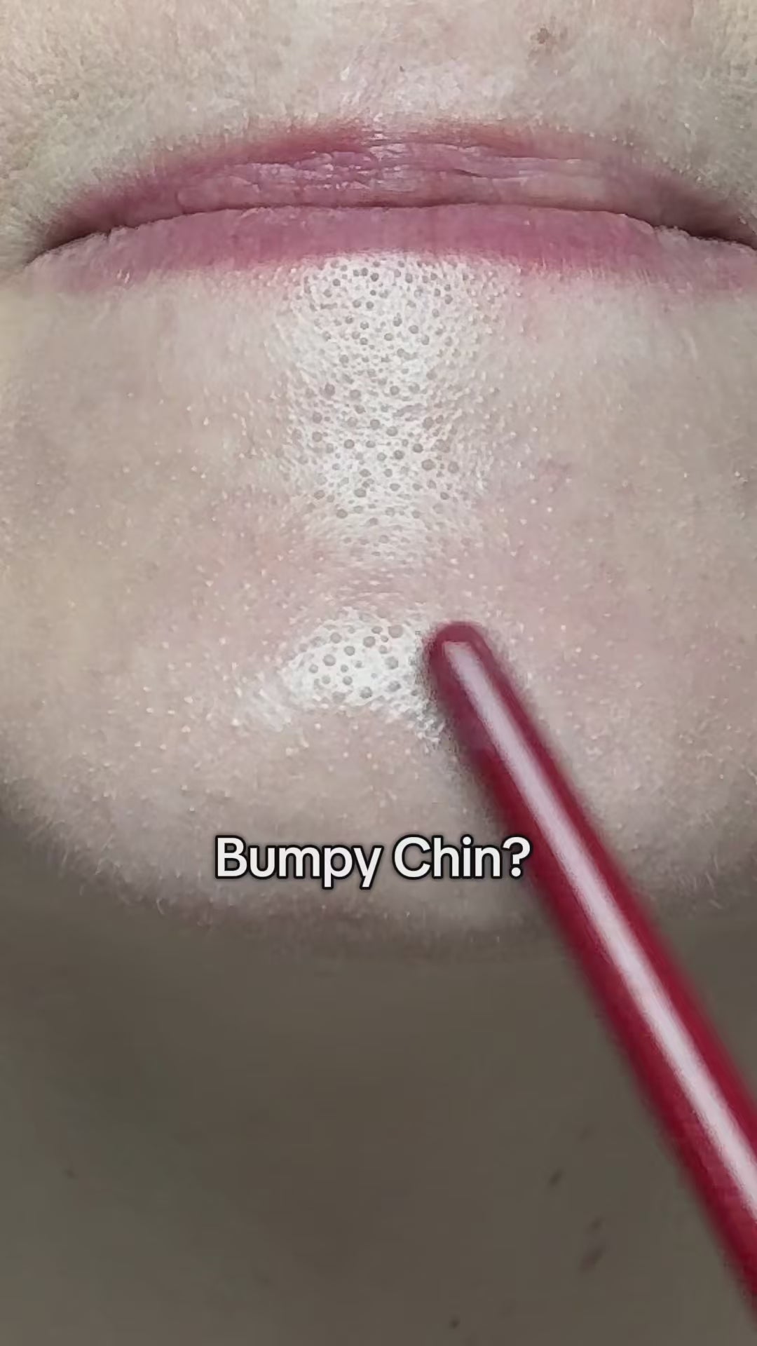 Exfoliant & Purifying Rice Ampoule video