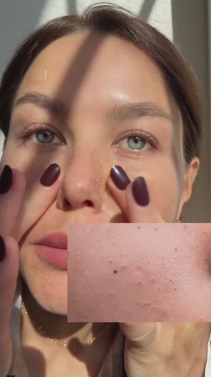 Dr.Melaxin - Peel Shot Duo Bundle Set video