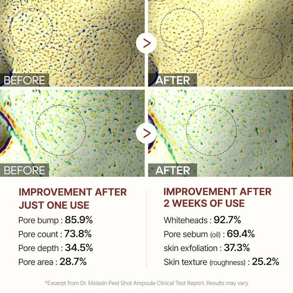 Dr.Melaxin - Peel Shot Duo Bundle Set